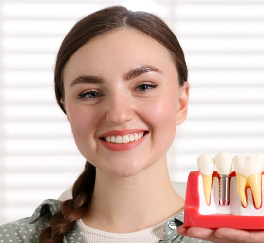 Dental Implants