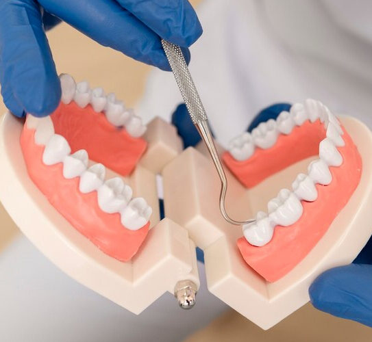 Partial & Full Dentures