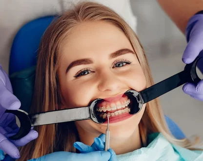 How to Fix Underbite in Adults with Expert Orthodontic Care